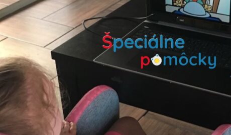 TD PCEye5  Očná navigácia je prístroj na bezdotykové ovládanie počítača očami  O...